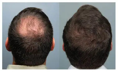 Aryusutra Hair Growth Oil – Buy 1 Get 1 Sampoo FREE