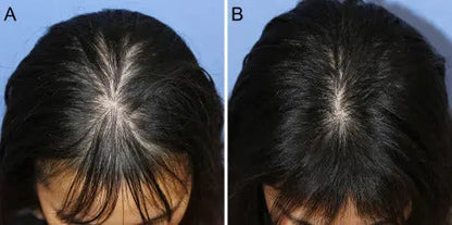 Aryusutra Hair Growth Oil – Buy 1 Get 1 Sampoo FREE
