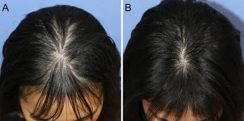 Aryusutra Ayurvedic Hair Oil for Hair Growth | Control Hair loss & Dandruff |