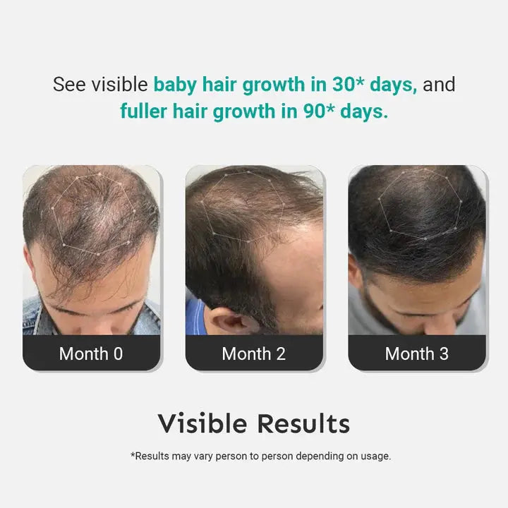 Best Hair Serum for Women & Men