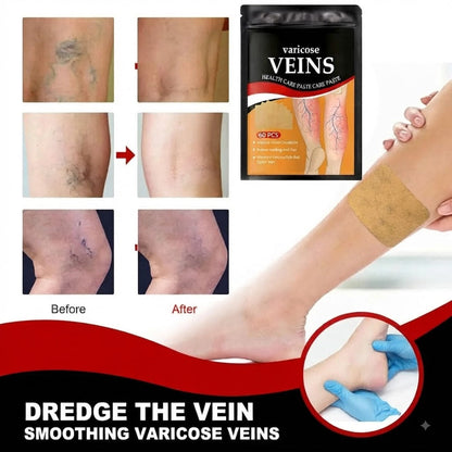 HerbPatch™ Varicose Veins Health Care Paste | Pain Relief & Blood Circulation Support (Pack of 60) Buy 1 Get 1 Free