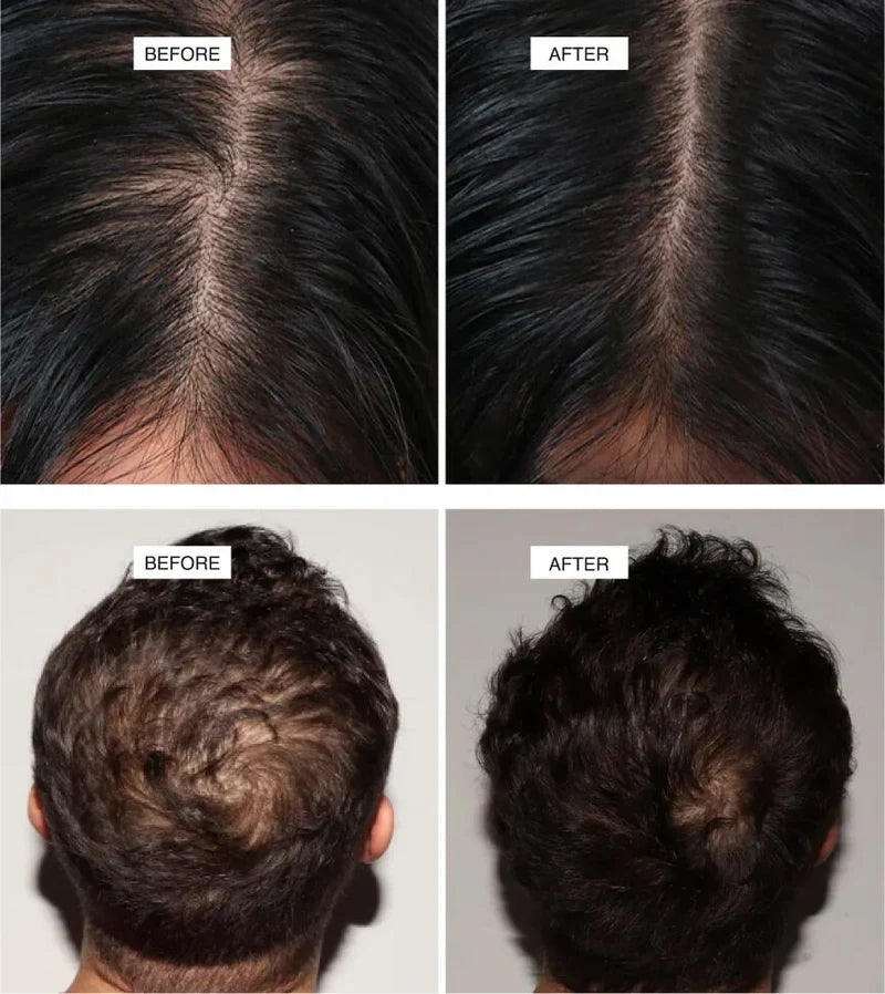 Aryusutra Ayurvedic Hair Oil for Hair Growth | Control Hair loss & Dandruff |
