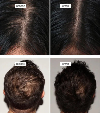 Aryusutra Ayurvedic Hair Oil for Hair Growth | Control Hair loss & Dandruff |